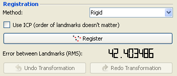 QmitkRegistration_RegistrationPointBased.png