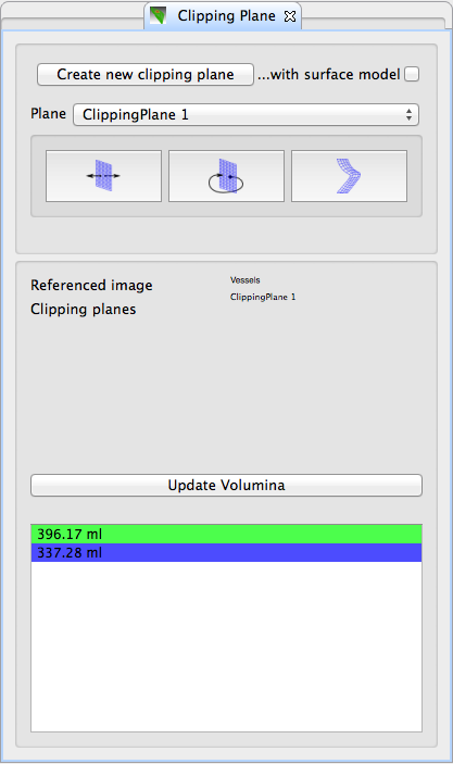 QmitkClippingPlane_Overview2.png
