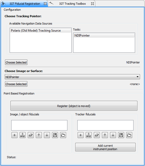 QmitkIGTTracking_RegistrationView.png