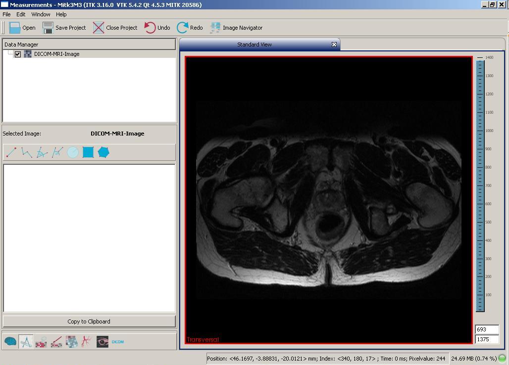 QmitkMeasurementToolbox_ImageLoadedScreen.jpg