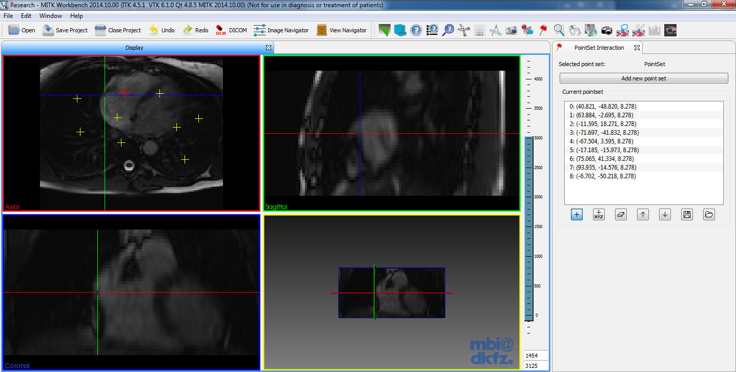 QmitkPointSetInteraction_Screenshot.png