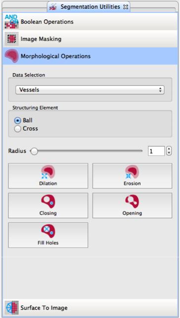 QmitkSegmentationUtilities_Overview.png