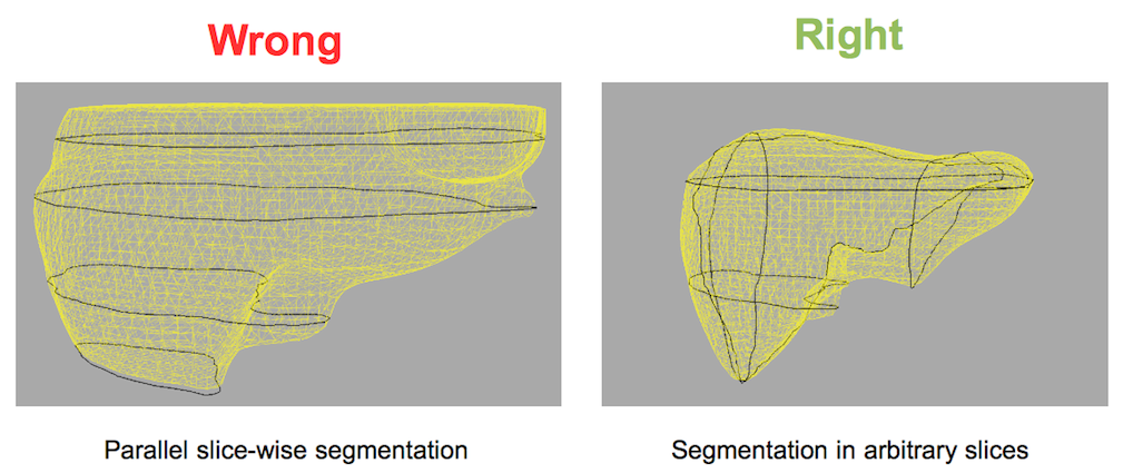 QmitkSegmentation_3DInterpolationWrongRight.png