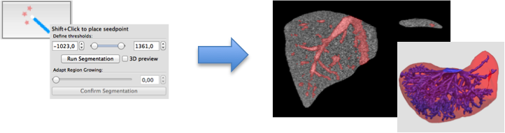 QmitkSegmentation_3DRGTool.png