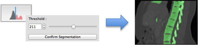 QmitkSegmentation_3DThresholdTool.png
