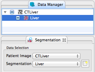 QmitkSegmentation_IMGSelection.png