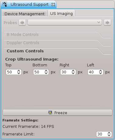QmitkUltrasound_Imaging.png