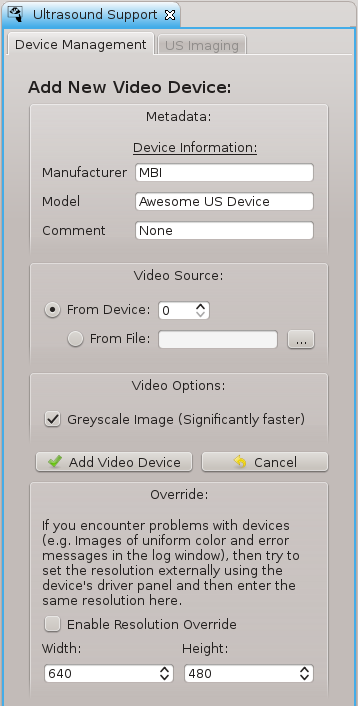 QmitkUltrasound_NewVideoDevice.png