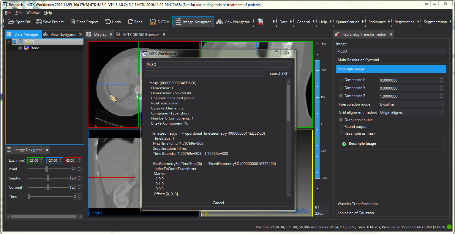 RadiomicsTutorial_GUI_Step3_01_DetailView.png
