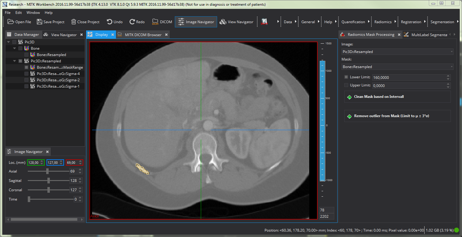 RadiomicsTutorial_GUI_Step3_02_FinishedPreprocessing.png
