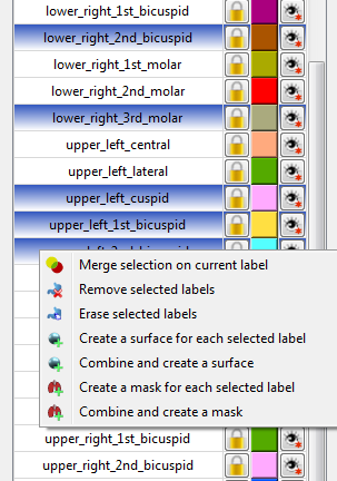 org_mitk_views_multilabelsegmentationIMGLabelTableMultipleSelectionContextMenu.png